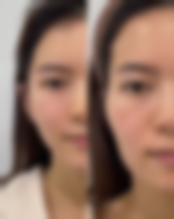 七、延吉美艺医学美容诊所价格表：（仅供参考）