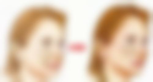 烫伤疤痕印去除有妙招?日常护理不能少