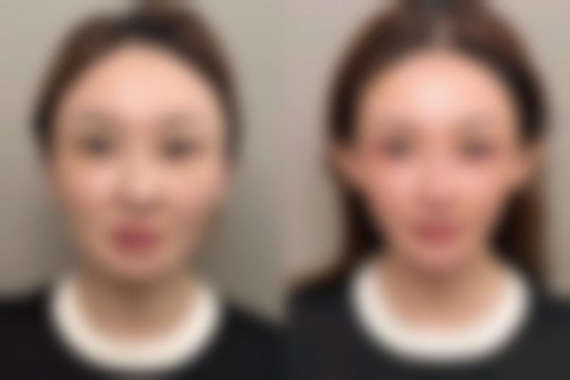 八、长沙艺脂医疗美容门诊真实的顾客评价如下: