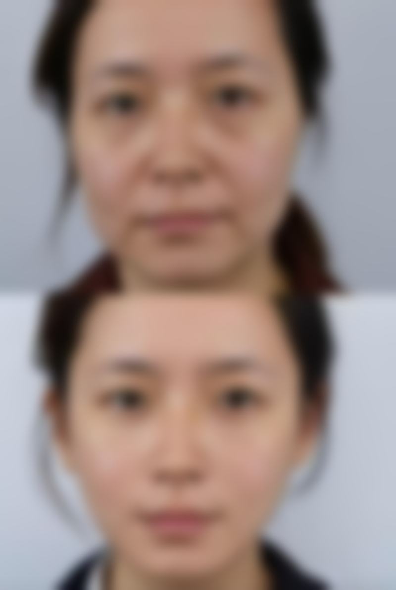 六、郑州薛正钦整形医疗美容诊所价格表:(仅供参考)