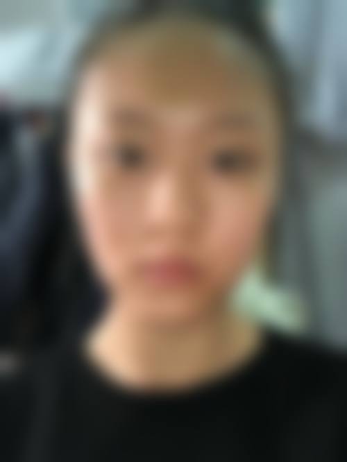 七、建水县人民医院(皮肤科(医学美容科))价格表：（仅供参考）