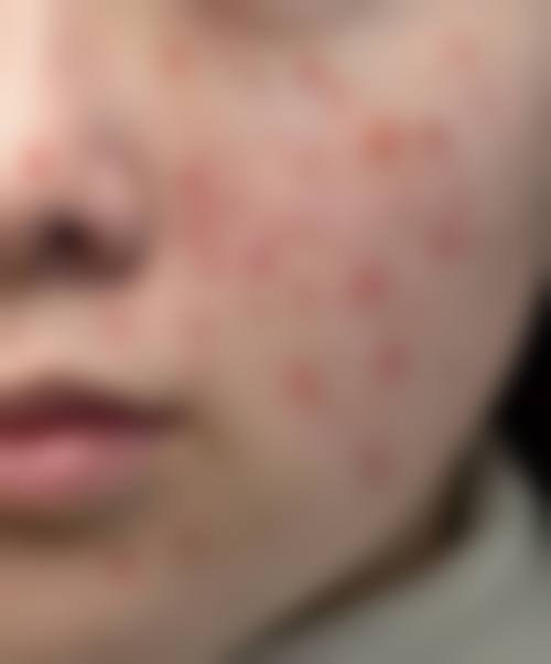梁静医生在哪家医院怎么预约?