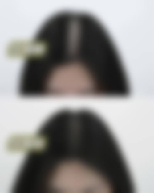 七、广州雍禾植发价格表:(仅供参考)