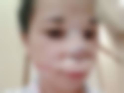 眼皮松弛别怕!双眼皮手术重塑紧致双眸大揭秘