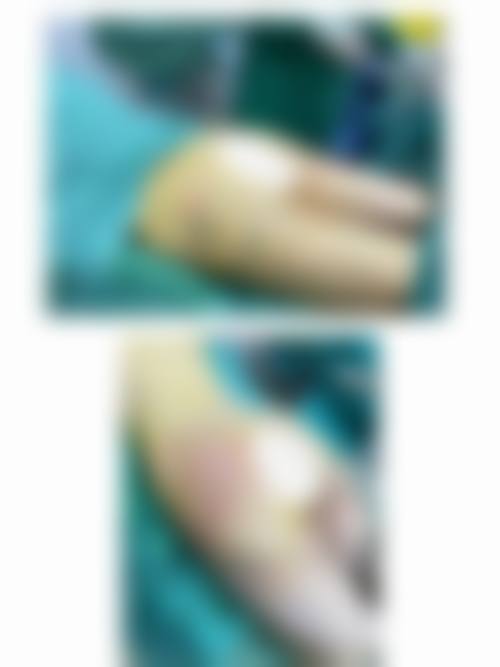 八、北京悦丽格医疗美容诊所真实的顾客评价如下: