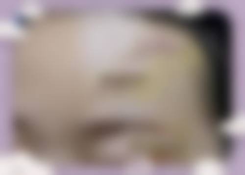 八、内蒙古包头伽蓝(原巴诺巴奇)医疗美容门诊部真实的顾客评价如下:
