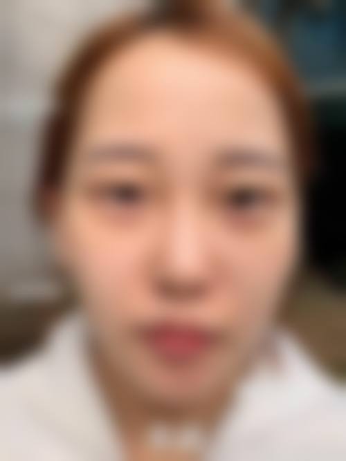 八、桂林华美整形医院真实的顾客评价如下: