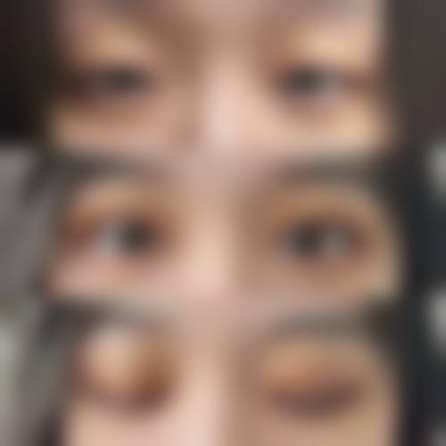 七、韩国EG童颜医院价格表：（仅供参考）