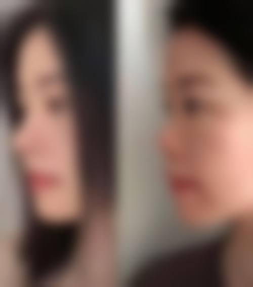八、徐州矿务集团总医院整形美容中 心真实的顾客评价如下：