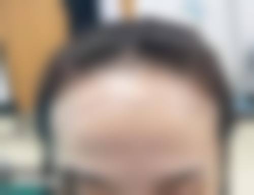 六、无锡百年植发专科门诊部怎么预约：