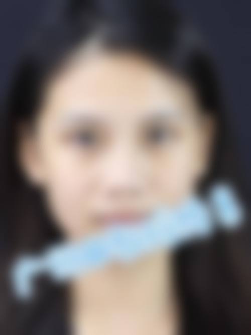 六、镇江晶悦整形医疗美容门诊部价格表：（仅供参考）