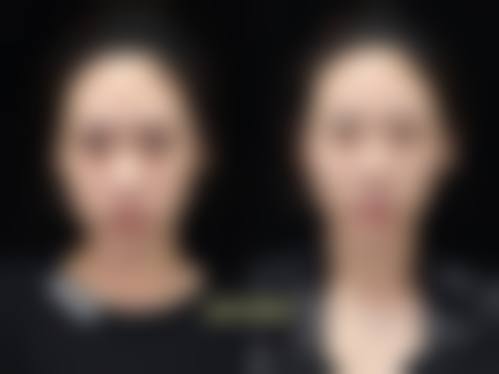 八、海口梦妮幻整形外科门诊部真实的顾客评价如下：