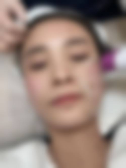 四、韩国Celin皮肤科开展的主要项目和特色项目：