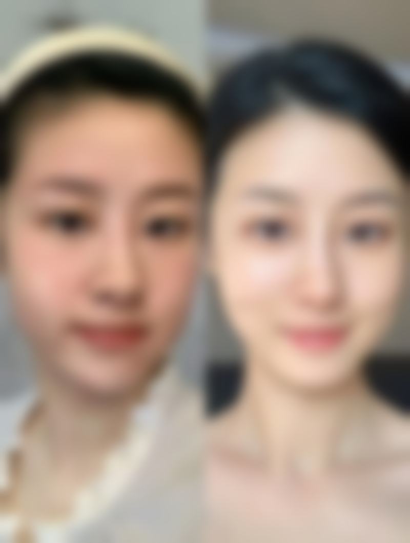 六、韩国Celin皮肤科怎么预约：