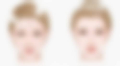 想知道如何精准区分单双眼皮？从眼睑特征、眼裂形态及睫毛状态入手教你辨别