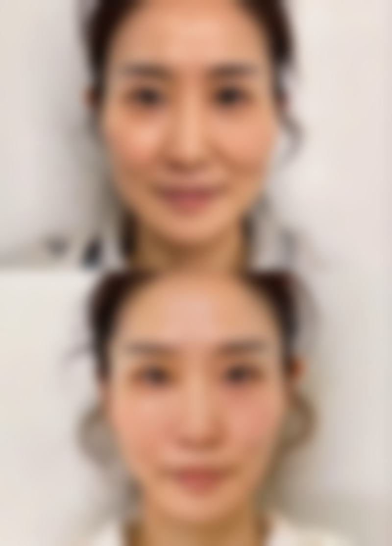 伤口愈合后疤痕发黑?日常护理来帮忙