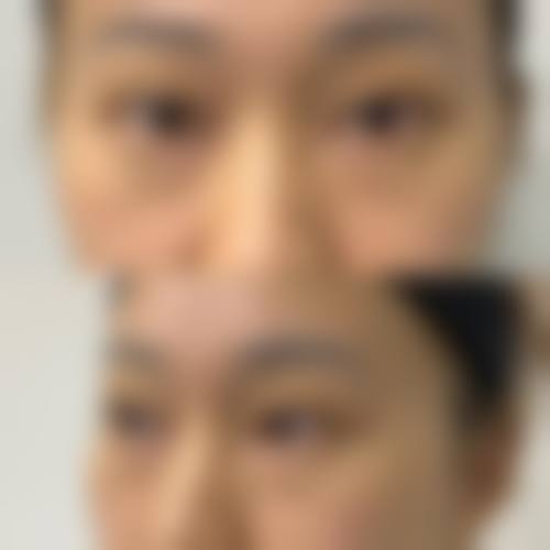 八、景德镇慕一整形医院真实的顾客评价如下: