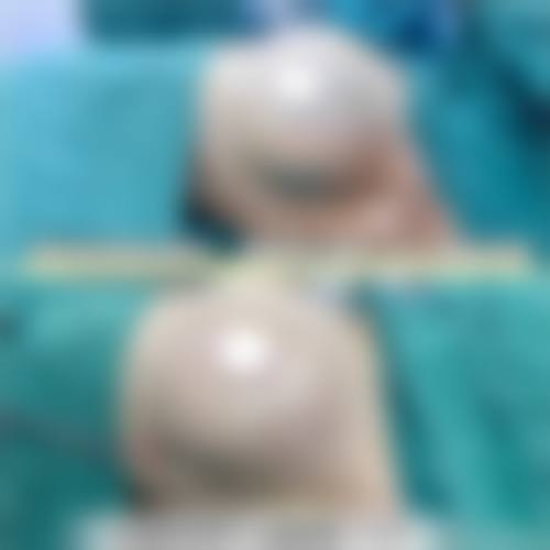 陈秀荣医生实例