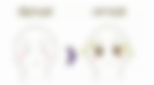 如何根据个人审美偏好选对双眼皮形态