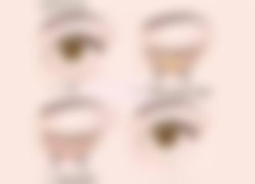 疤痕增生变软是好征兆吗?不同类型疤痕软化周期