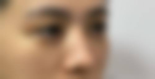 六、深圳有米医疗美容诊所怎么预约: