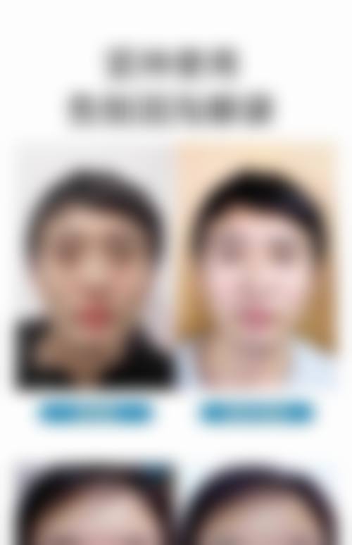 五、邯郸第五医院整形科实例
