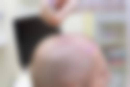 八、南昌发森林植发医疗美容诊所真实的顾客评价如下: