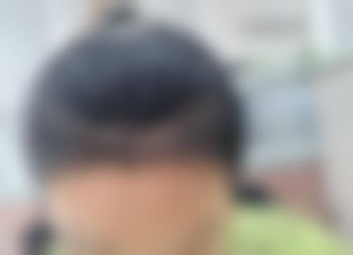六、青云植发连锁怎么预约: