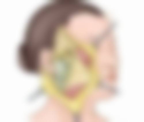 手术缝针疤痕消除之疤痕修复时机