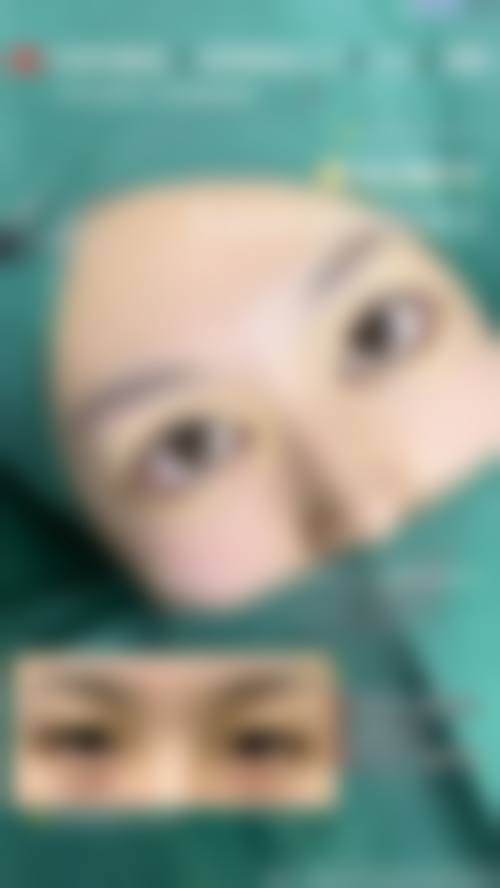 五、北京京韩整形医院实例