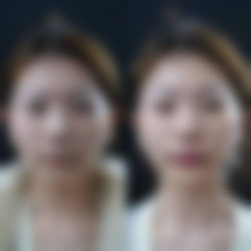 六、韩国Generless皮肤科价格表:(仅供参考)