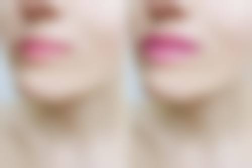 七、韩国Generless皮肤科真实的顾客评价如下: