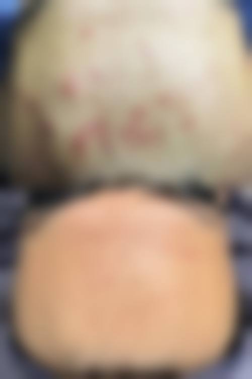七、淮北苗医生祛痘祛斑美容院价格表:(仅供参考)
