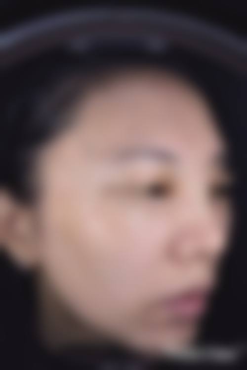 五、韩国Generless皮肤科怎么预约: