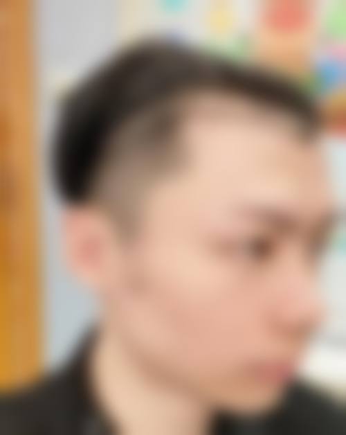 三、长沙禧朵植发医院医生介绍: