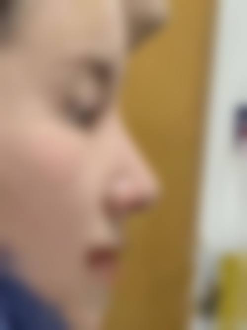 六、金华奕美医疗美容门诊部怎么预约: