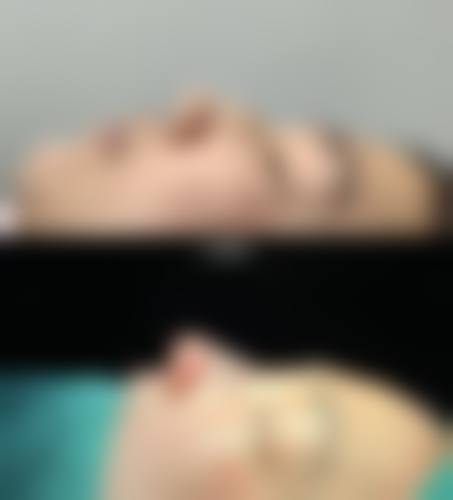 李汉正医生实例