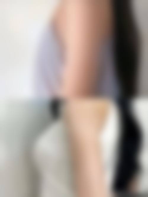 五、鞍山铁东崔芳医疗美容整形医院实例