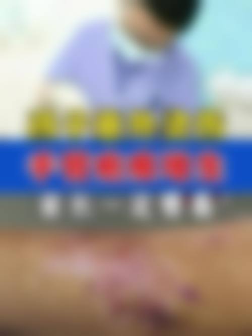 林伟华医生怎么样可靠吗?