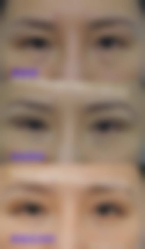 五、朝阳市第二医院整形美容科实例