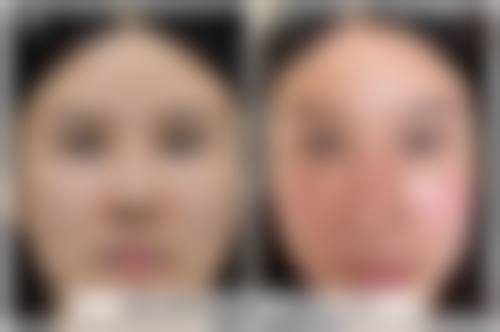 八、朝阳市第二医院整形美容科真实的顾客评价如下: