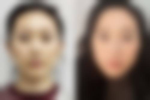 五、北京丽德医疗美容医院实例
