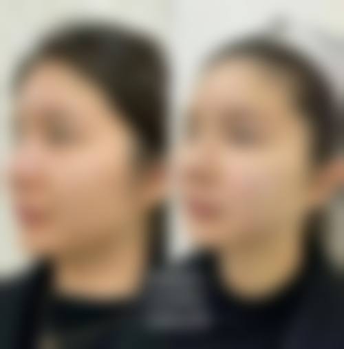 八、海南省人民医院(整形美容外科)真实的顾客评价如下：