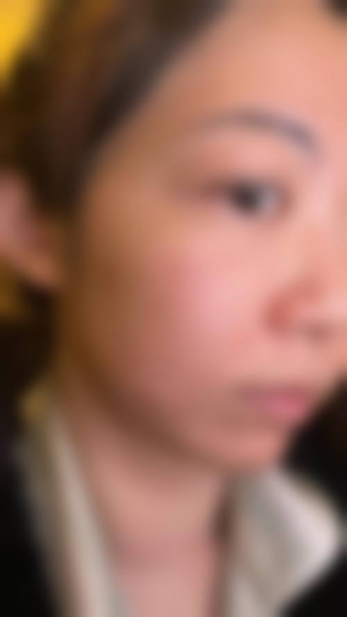 八、阜阳光美医疗美容门诊部真实的顾客评价如下: