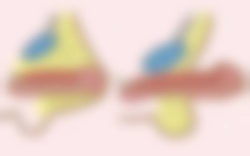 脸上黑色疤痕去除有妙招?坚持就是胜利