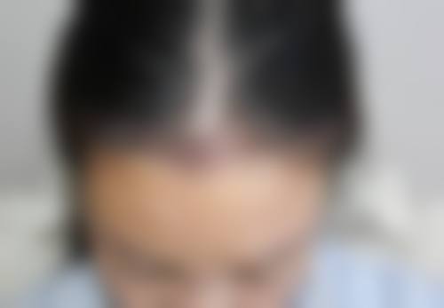 八、武汉华美整形外科医院植发科真实的顾客评价如下：