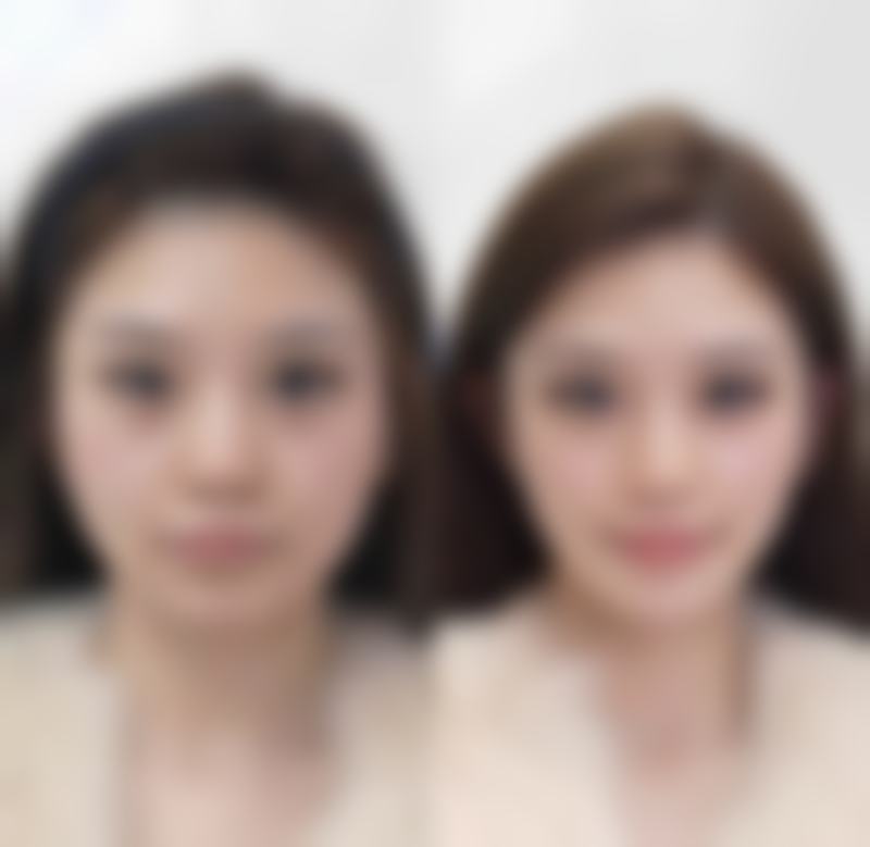 七、包头市第八医院整形创伤皮肤美容科价格表:(仅供参考)
