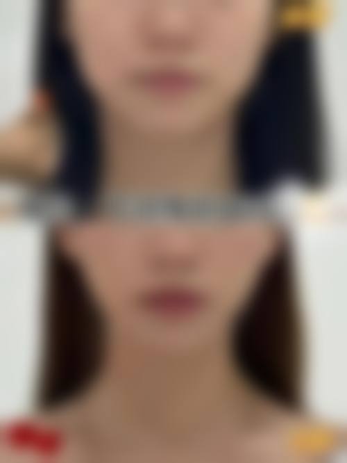 四、深圳橙蝶医疗美容诊所实例
