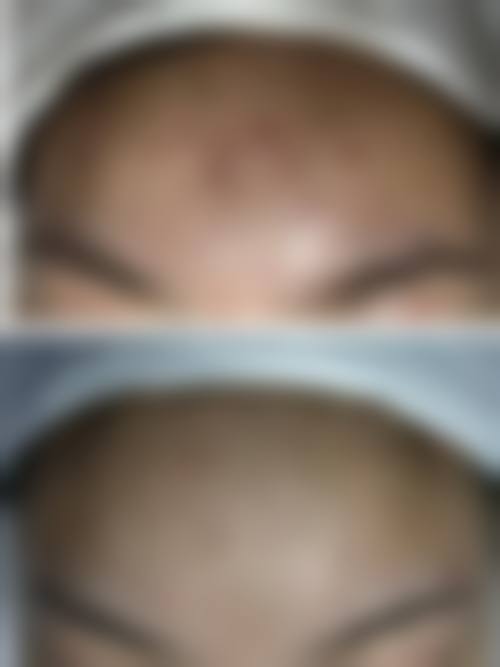 二、建瓯市疾病预防控制中 心皮肤病性病防治院正规吗?来看看医院资质: