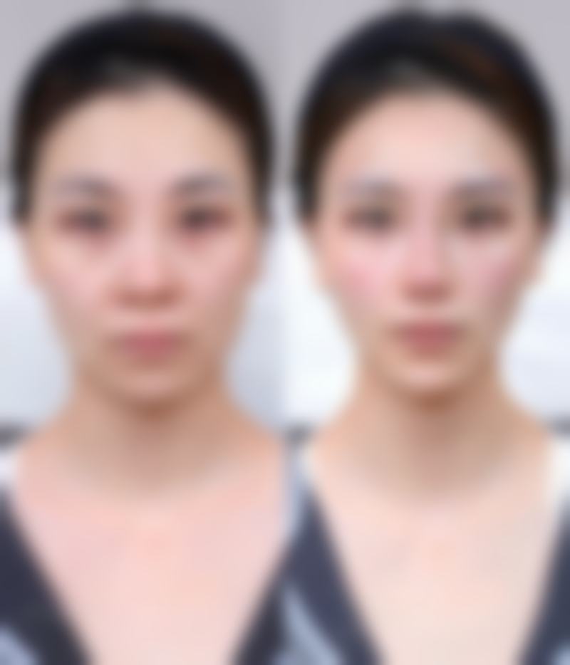 八、北京市肛肠医院(肛肠疾病整形修复门诊)真实的顾客评价如下: